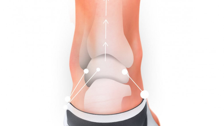 Are Insoles Worth It? 6 Reasons They Definitely Are
