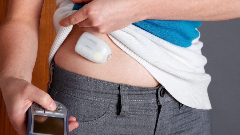 Disposable Insulin Pumps Market to Experience Significant Growth during the Forecast Period 2021-2028