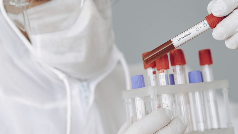 Fast Result Covid Testing