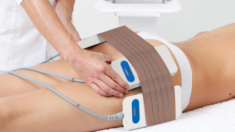 Lipo laser-innovation in slimming and shaping