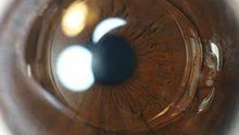 Intraocular Lens (IOLs) Market New Innovations, Top Countries Data and Forecast by 2026