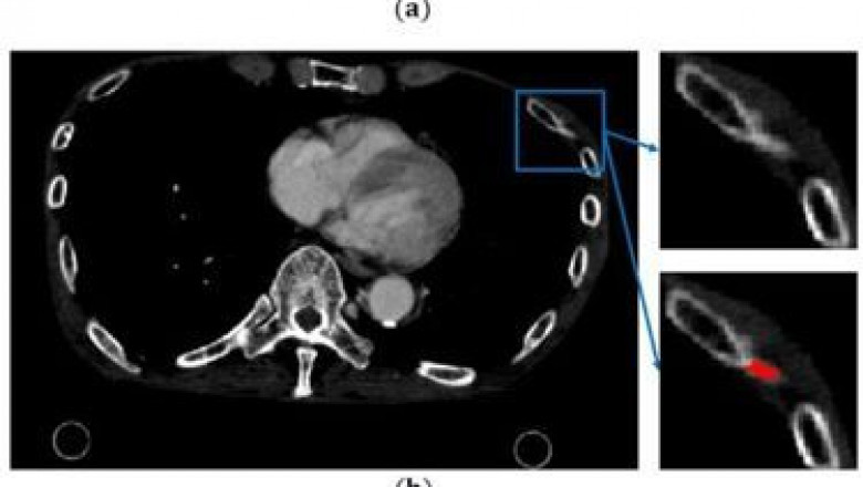 Japanese Journal of Gastroenterology and Hepatology