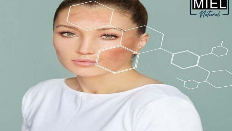Miel Natural | What Are Free Radicals & How Do They Affect My Skin?
