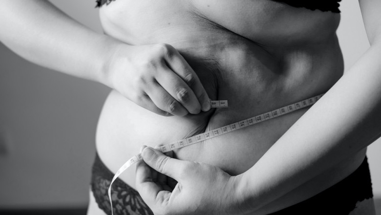 Essential ways to maintain your liposuction results