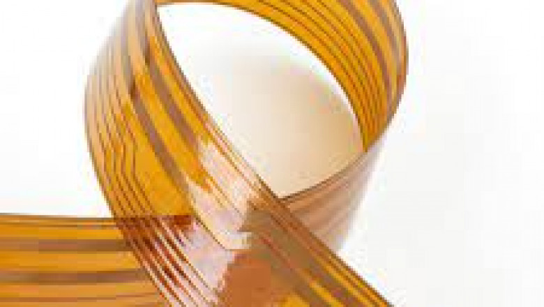 Flexible Heating Element Market Status 2021 Future Trends during Forecast 2026
