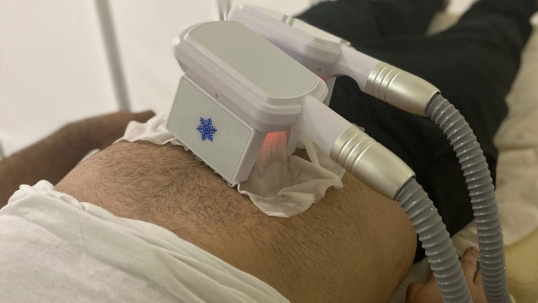 The Whole Truth About Fat Freezing
