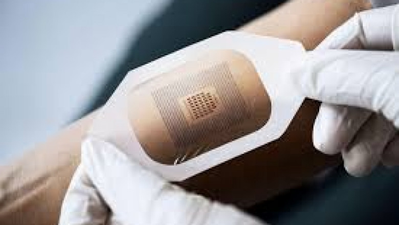 Wearable Adhesives Market Industry Analysis by Size, Competitors Classification, Share, Growth, Trends, and Forecast to 2026