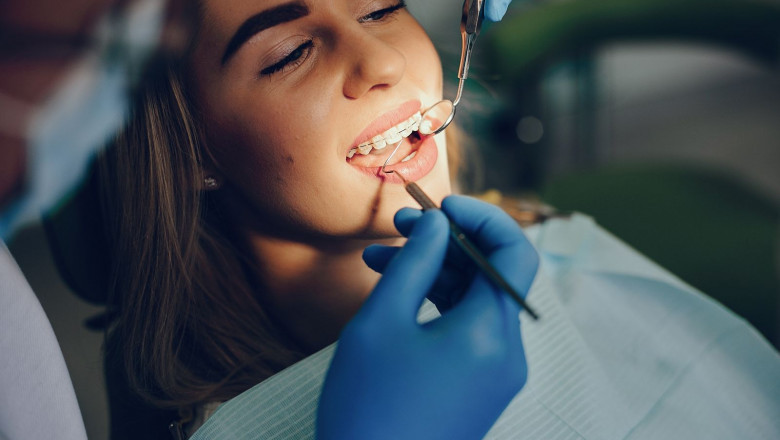 ROOT CANAL TREATMENT