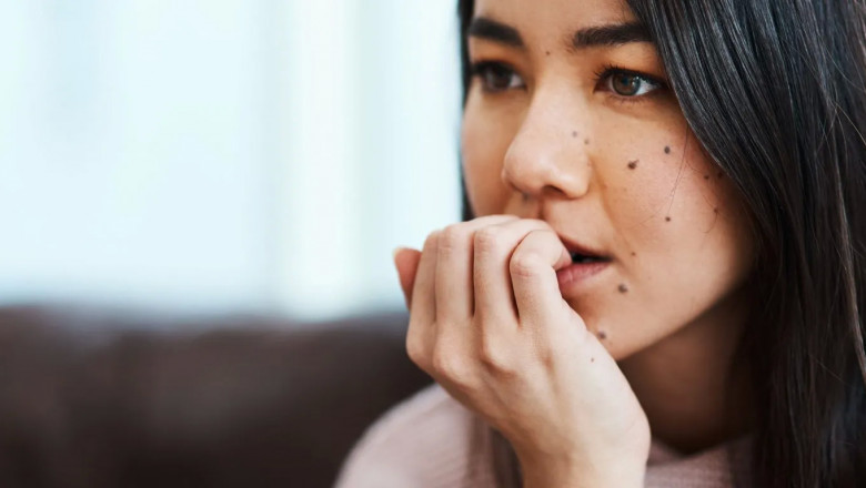 Plagued by Self-Doubt- Here are Some Tips You can Follow