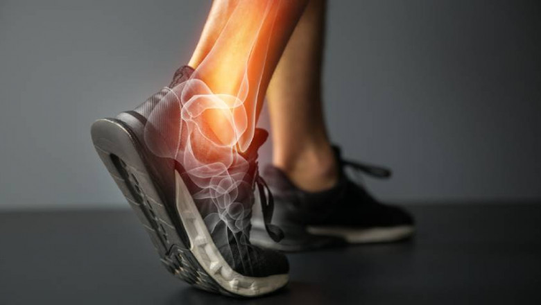 7 Tips for Preventing Sports Injuries