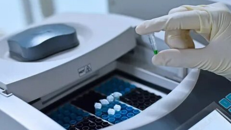 PCR Machine Market Analysis, Growth Drivers and Share Forecast to 2026