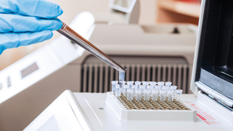 Specimen Validity Testing Market 2022 Growth, Latest Trend Analysis and Forecast 2028