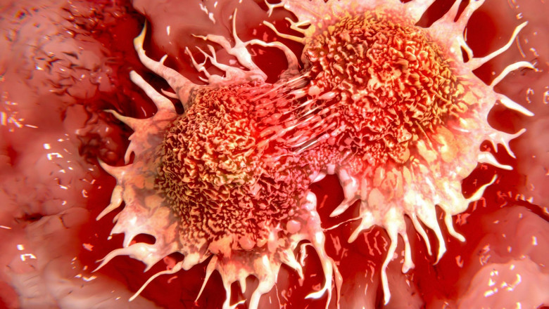What distinguishes cancer cells from normal cells 12?