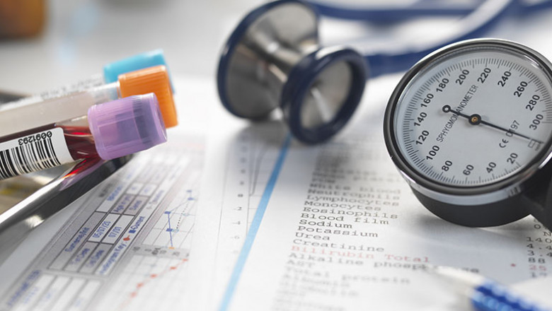 Lactate dehydrogenase Test Market 2022 Top Leading Player, Demand, Revenue, Statistics, Business Growth Analysis 2029