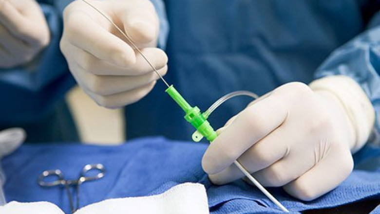 North America Is Expected To Account For The Largest Share Of The Global Cardiac Ablation Catheters Market In 2016, Followed By Europe