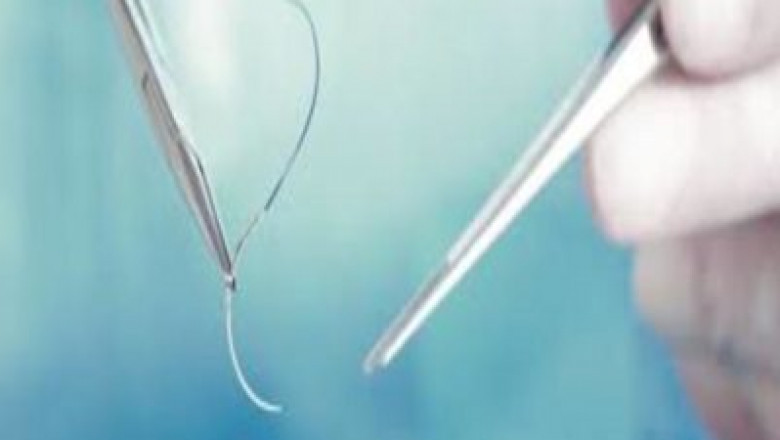 . Surgical Sutures Market Size, Share, Growth Dynamics, Revenue Outlook and Opportunities Forecast 2026