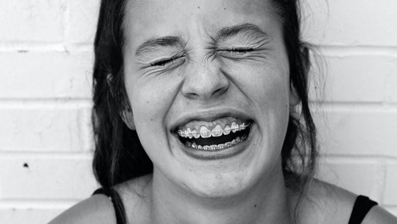 5 Healthy Dental Practices for Every Kid with Braces