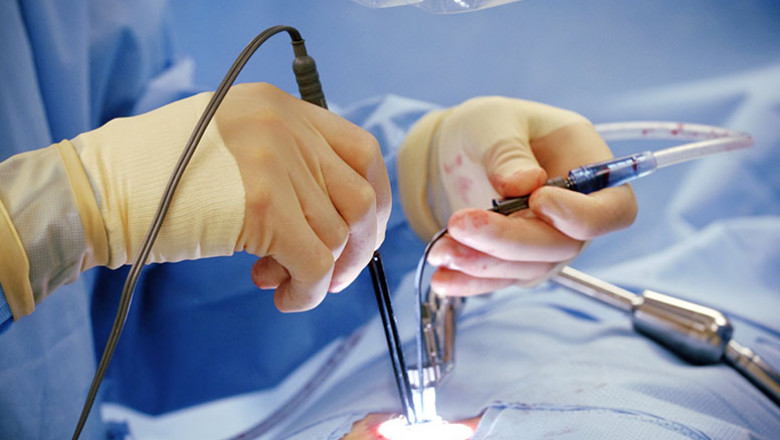Global Minimally Invasive Surgery Market Size, Status and Forecast 2027