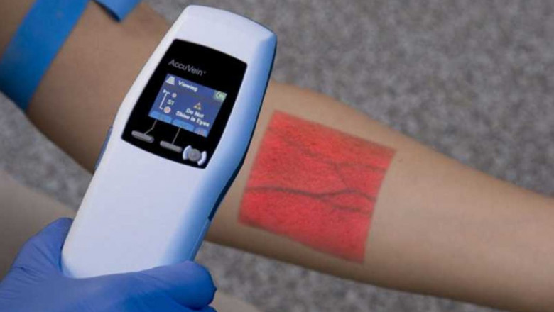 Development in Global Vein Finders Market