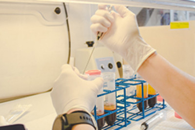 New Approach of Amniotic Products Market 2021: To Business Applications with Top Key Players like Applied Biologics , Lucina BioSciences