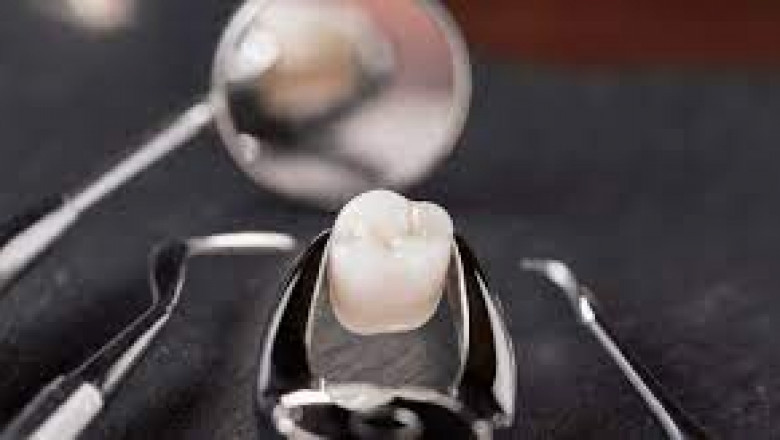 What Are The 6 Important Things You Should Consider Before Choosing The Best Orthodontist?