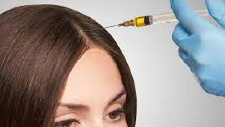 Get Super PRP Therapy Results with 7 Magic Tips