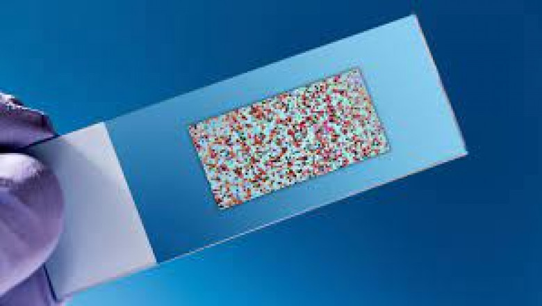 Biochips Market: Global Industry Trends, Share, Size, Growth, Opportunity and Forecast 2021-2026