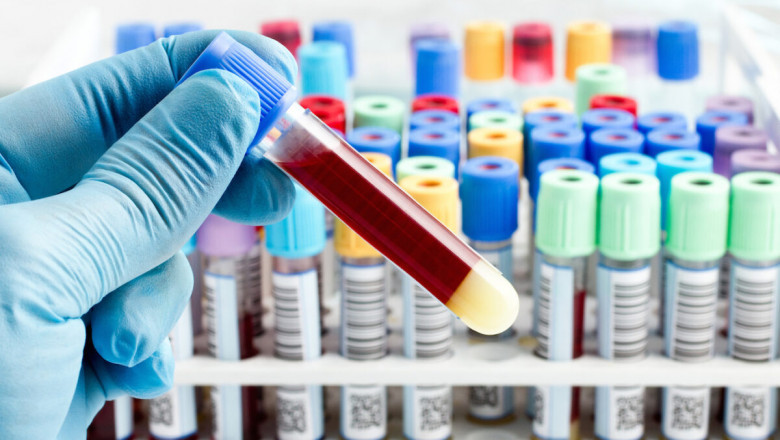 Global Blood Coagulation Tubes Market Overview