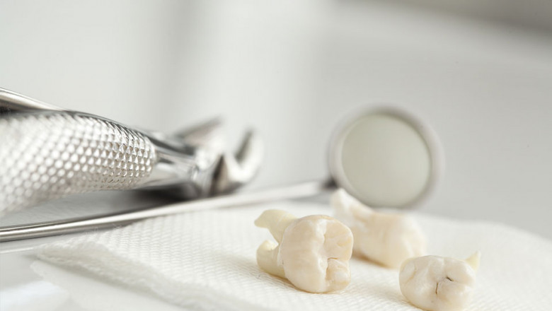 What More Do You Need To Know About Cracked Teeth?