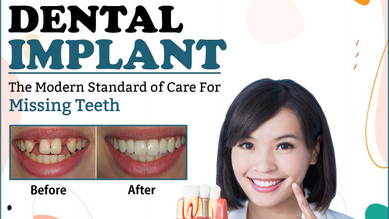 Best Implantologist in Gurgaon