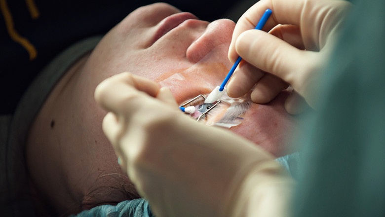 What is LASIK Surgery