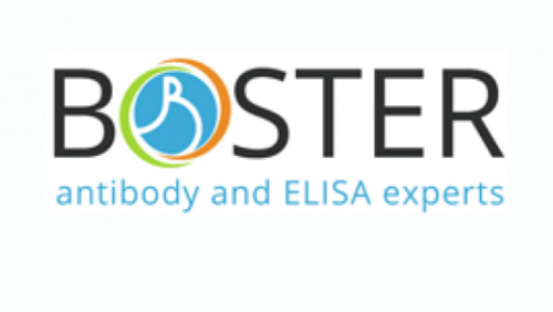 Quantitate Human IL6 Elisa Kit