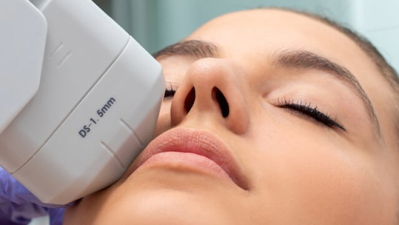 Reveal Your Glowing Complexion With Skin Pigmentation Treatment