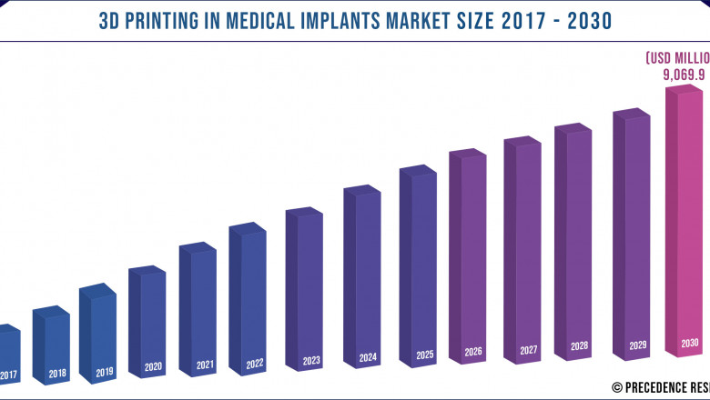 3D Printing Medical Implants Market to Expand at a CAGR of 19% from 2021 to 2030