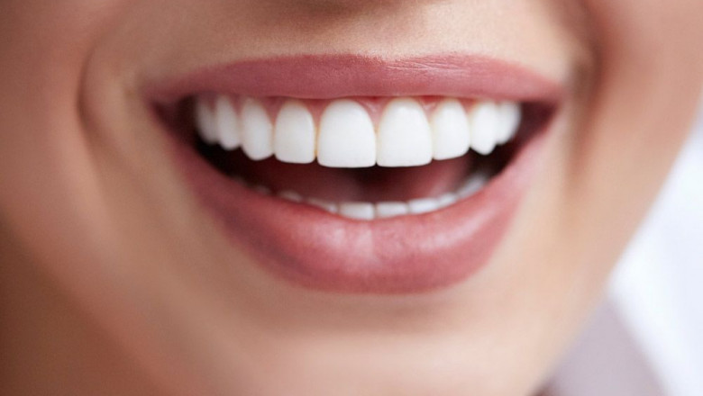 What Is The Procedure Of Dental Implants?