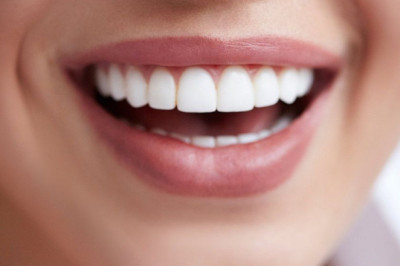 What Is The Procedure Of Dental Implants?