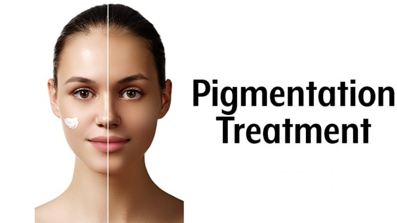 10 Tips: Laser Treatment for Pigmentation You Must Know