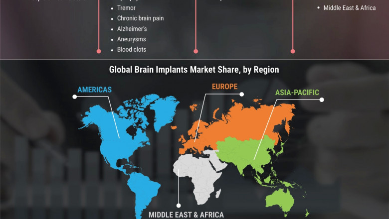 Brain Implants Market Worth USD 5261.08 Mn by 2023 at 9.3% CAGR | Advancing AI to Drive Brain Implants Industry