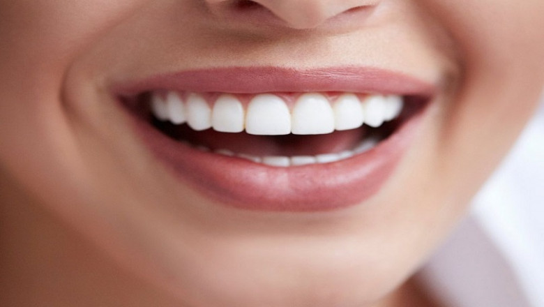 What Do You Mean By Dental Implants?