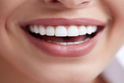 What Do You Mean By Dental Implants?