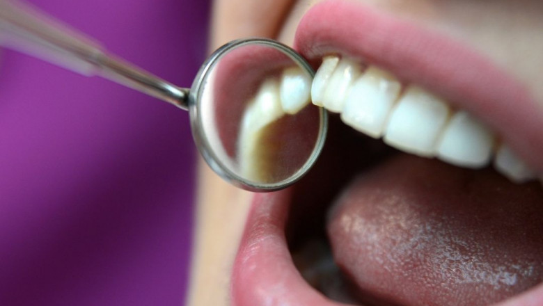 Local Emergency Dentist 24/7 Near Lexington, KY 40502 | Emergency Dental Service