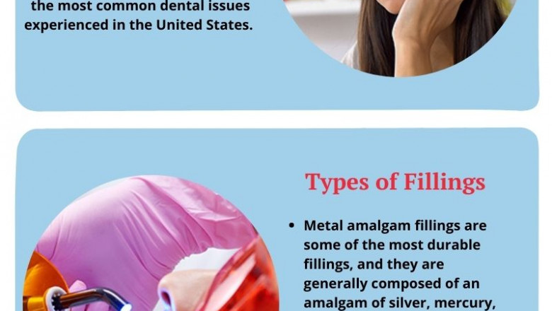 How Long Do Fillings Take for Tooth Cavities? | Emergency Dental Service