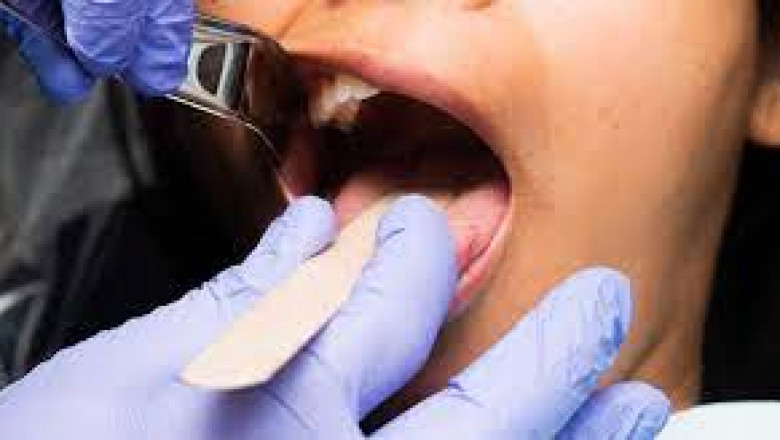 What Are The Benefits Of Dentures?