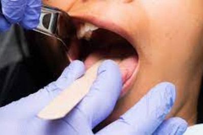 What Are The Benefits Of Dentures?