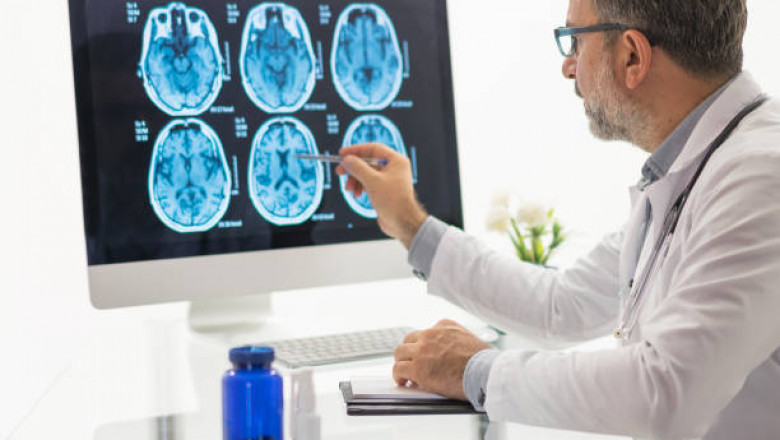 Who is the best neurologist in Jaipur?