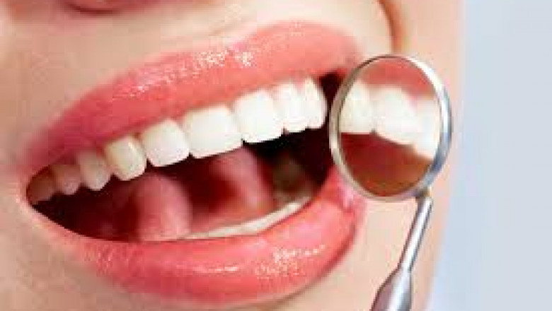 Why Do You Need Teeth Cleaning?
