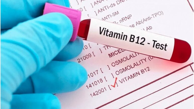 Some signs of vitamin B12 deficiency that should know about
