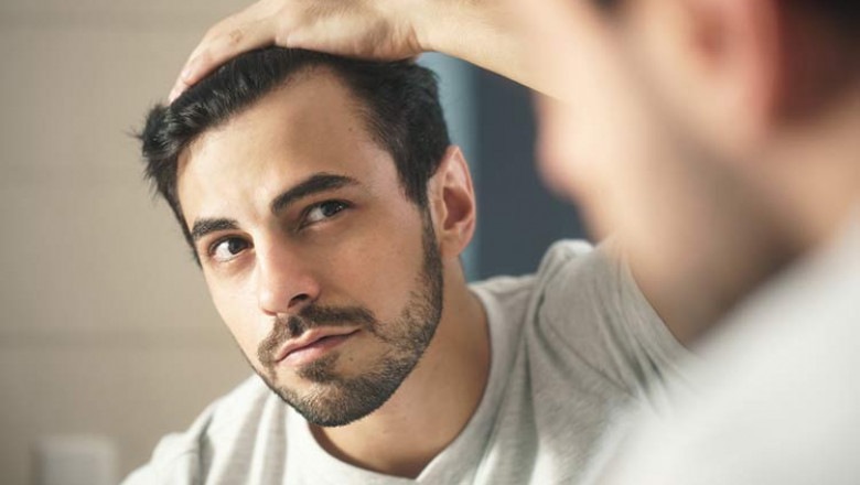 Who Is The Ideal Candidate For Hair Transplantation?