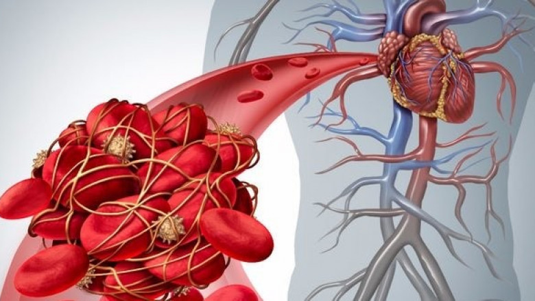 Hematologic Malignancies Market Share, Size, Trends, Growth and Opportunities by 2021-2026