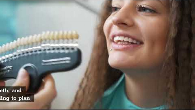 Invisalign Sherman Oaks